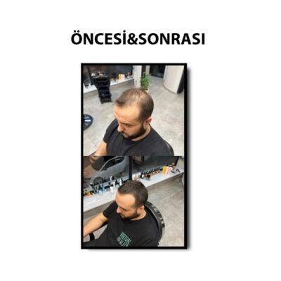 کرم پرکننده کانسیلر مو Batçı